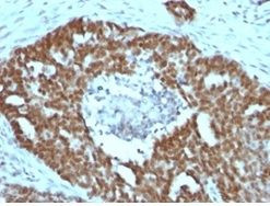 NUCLEOLIN