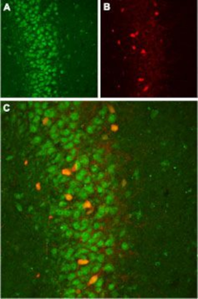 SLO BETA 2 (KCNMB2) ANTIBODY