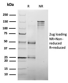 MLH1 (MUTL HOMOLOG 1)/HNPCC AN