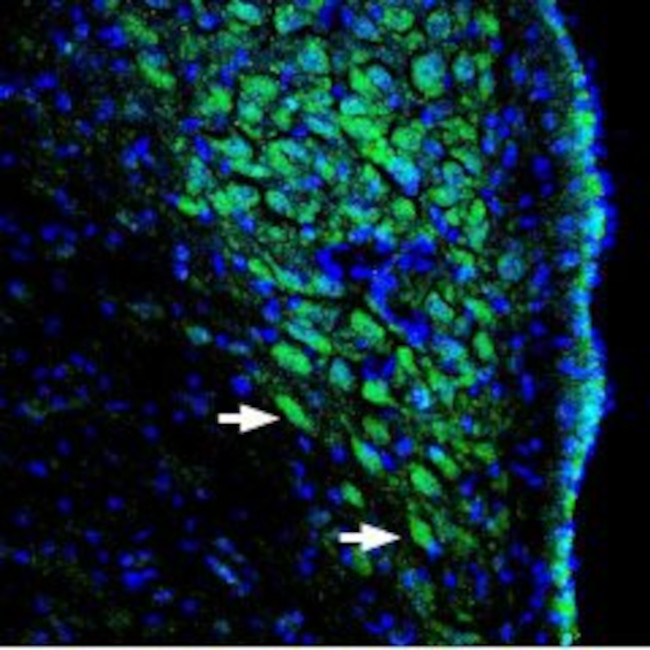 PAN ASIC (EXTRACELLULAR) ANTIB
