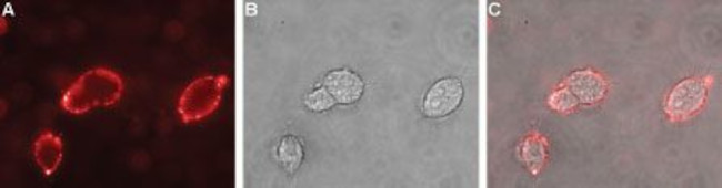 NICOTINIC ACETYLCHOLINE RECEPT