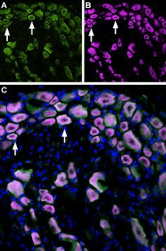 TRPM8 (EXTRACELLULAR) ANTIBODY