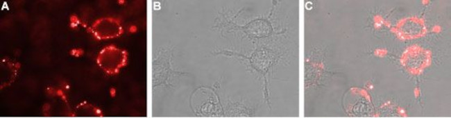 NICOTINIC ACETYLCHOLINE RECEPT