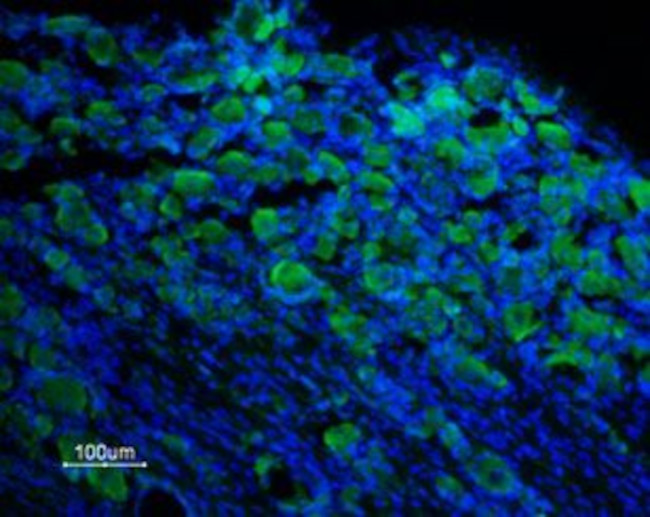 TRPM8 (EXTRACELLULAR) ANTIBODY