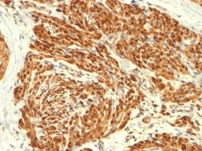 CALPONIN-1 (SMOOTH MUSCLE MARK