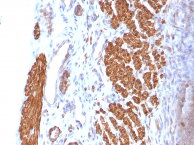 CALPONIN-1 (SMOOTH MUSCLE MARK